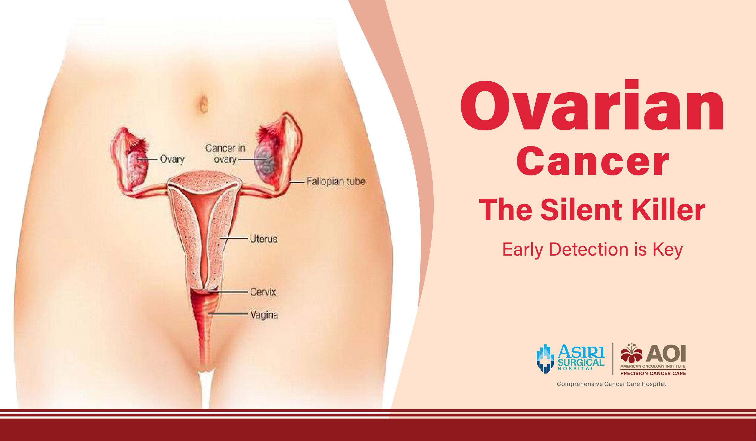 241002091007Ovarian_Cancer_The_Silent_Killer__Early_Detection_is_Key-01.jpg